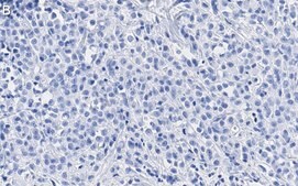 Anti-SSNA1 Antibody, clone 4C4 ZooMAb® Rabbit Monoclonal recombinant, expressed in HEK 293 cells