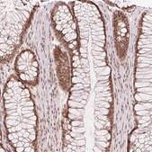 Anti-DEK antibody produced in rabbit Prestige Antibodies&#174; Powered by Atlas Antibodies, affinity isolated antibody, buffered aqueous glycerol solution