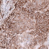 Anti-CD44 antibody produced in mouse Prestige Antibodies® Powered by Atlas Antibodies, clone CL13324, purified by using Protein A, buffered aqueous glycerol solution