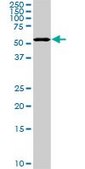 Monoclonal Anti-PAPSS2 antibody produced in mouse clone 2A8, purified immunoglobulin, buffered aqueous solution