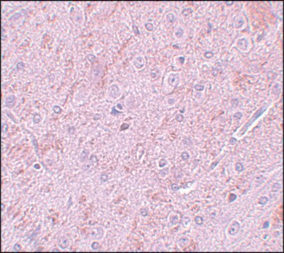 Anti-PIAS2 antibody produced in rabbit affinity isolated antibody, buffered aqueous solution