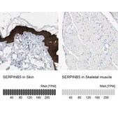 Anti-SERPINB5 antibody produced in rabbit Prestige Antibodies&#174; Powered by Atlas Antibodies, affinity isolated antibody, buffered aqueous glycerol solution