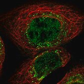 Anti-FAM219A antibody produced in rabbit Prestige Antibodies® Powered by Atlas Antibodies, affinity isolated antibody, buffered aqueous glycerol solution