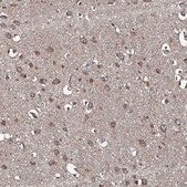 Anti-SNX32 antibody produced in rabbit Prestige Antibodies&#174; Powered by Atlas Antibodies, affinity isolated antibody, buffered aqueous glycerol solution