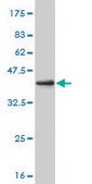 ANTI-RCV1 antibody produced in mouse clone 4D9, purified immunoglobulin, buffered aqueous solution