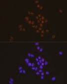 Anti-STAT6 Antibody, clone 4G7J8, Rabbit Monoclonal