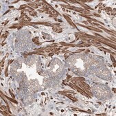 Anti-PIEZO2 antibody produced in rabbit Prestige Antibodies® Powered by Atlas Antibodies, affinity isolated antibody, buffered aqueous glycerol solution