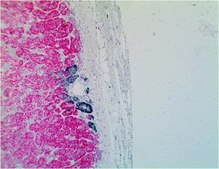 Anti-CYP11B1 Antibody, clone 80-7 clone 80-7, from rat