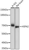 Anti-HSPA2 Antibody, clone 5C9X0, Rabbit Monoclonal