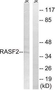 Anti-RASSF2 antibody produced in rabbit affinity isolated antibody