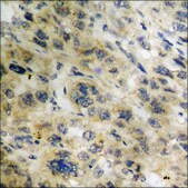 Anti-phospho-p70 S6 Kinase (pThr421) antibody produced in rabbit affinity isolated antibody