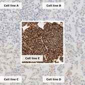 Breast Analyte ControlDR Cell line controls for immunohistochemistry and in situ hybridization