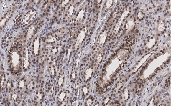 Anti-MLL/HRX CT Antibody, clone 5C15 ZooMAb&#174; Rabbit Monoclonal recombinant, expressed in HEK 293 cells