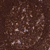 Anti-PTPRCAP antibody produced in rabbit Prestige Antibodies&#174; Powered by Atlas Antibodies, affinity isolated antibody, buffered aqueous glycerol solution