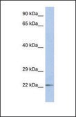 Anti-DUT, (N-terminal) antibody produced in rabbit affinity isolated antibody