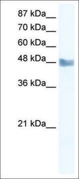 Anti-MAP3K8 antibody produced in rabbit IgG fraction of antiserum