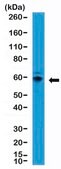 Anti-p70S6K Rabbit Monoclonal Antibody clone RM438, affinity purified immunoglobulin