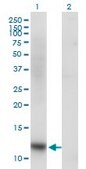 Monoclonal Anti-SNAPC5 antibody produced in mouse clone 5E2, purified immunoglobulin, buffered aqueous solution