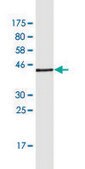 Monoclonal Anti-FMN1 antibody produced in mouse clone 4F4, purified immunoglobulin, buffered aqueous solution