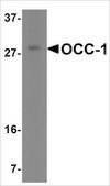 Anti-OCC-1 (ab2) antibody produced in rabbit affinity isolated antibody, buffered aqueous solution