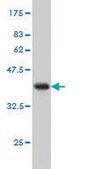 Monoclonal Anti-EMP3 antibody produced in mouse clone 3D4, purified immunoglobulin, buffered aqueous solution