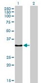 Monoclonal Anti-SSR1, (C-terminal) antibody produced in mouse clone 1C11, purified immunoglobulin, buffered aqueous solution