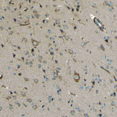 Anti-PDGFB antibody produced in rabbit Prestige Antibodies® Powered by Atlas Antibodies, affinity isolated antibody, buffered aqueous glycerol solution