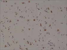 Anti-SATB2 antibody, Rabbit monoclonal recombinant, expressed in HEK 293 cells, clone RM365, purified immunoglobulin