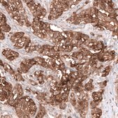 Monoclonal Anti-Msln Antibody Produced In Mouse Prestige Antibodies® Powered by Atlas Antibodies, clone CL13956, affinity isolated antibody, buffered aqueous glycerol solution