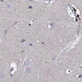 Anti-ACY3 antibody produced in rabbit Prestige Antibodies&#174; Powered by Atlas Antibodies, affinity isolated antibody, buffered aqueous glycerol solution