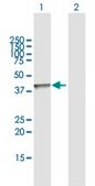 Anti-AACS antibody produced in rabbit purified immunoglobulin, buffered aqueous solution