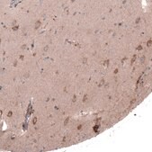 Anti-FASTKD1 antibody produced in rabbit Prestige Antibodies&#174; Powered by Atlas Antibodies, affinity isolated antibody, buffered aqueous glycerol solution