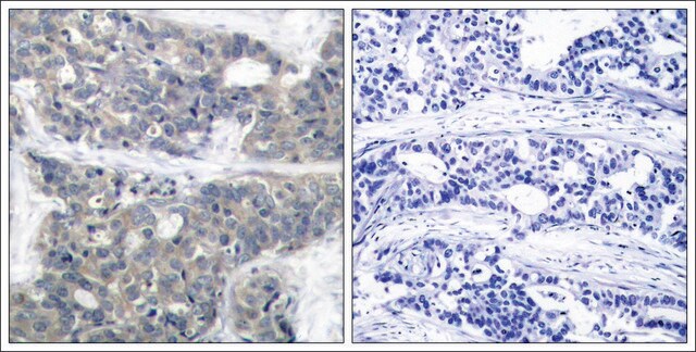 Anti-phospho-RPS6KB1 (pThr421) antibody produced in rabbit affinity isolated antibody