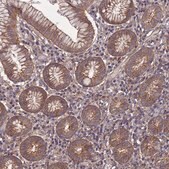 Anti-NDUFAF6 antibody produced in rabbit Prestige Antibodies® Powered by Atlas Antibodies, affinity isolated antibody, buffered aqueous glycerol solution