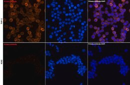 Anti-YKL-40/CHI3L1 Antibody, clone 7T1R3, Rabbit Monoclonal