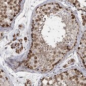 Anti-ATAD3B antibody produced in rabbit Prestige Antibodies&#174; Powered by Atlas Antibodies, affinity isolated antibody, buffered aqueous glycerol solution