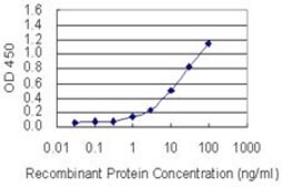 Monoclonal Anti-PIGW antibody produced in mouse clone 1D8, purified immunoglobulin