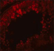 Anti-CRISP2 antibody produced in rabbit affinity isolated antibody, buffered aqueous solution