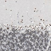 Anti-ZIC1 antibody produced in rabbit affinity isolated antibody, buffered aqueous glycerol solution