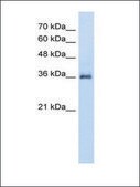 Anti-PPAP2A (AB2) antibody produced in rabbit IgG fraction of antiserum