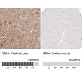 Anti-GDA antibody produced in rabbit Prestige Antibodies&#174; Powered by Atlas Antibodies, affinity isolated antibody, buffered aqueous glycerol solution