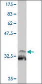 Monoclonal Anti-TITF1 antibody produced in mouse clone 2F6, purified immunoglobulin, buffered aqueous solution