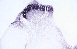Anti-Vanilloid Receptor Like Protein Antibody, pain, CT Chemicon&#174;, from rabbit