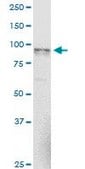 Monoclonal Anti-NAGLU antibody produced in mouse clone 1B7, purified immunoglobulin, buffered aqueous solution