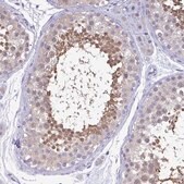 Anti-LDHC antibody produced in rabbit Prestige Antibodies&#174; Powered by Atlas Antibodies, affinity isolated antibody, buffered aqueous glycerol solution