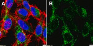 Anti-CPT1A Antibody, clone 2N14 ZooMAb® Rabbit Monoclonal recombinant, expressed in HEK 293 cells