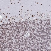 Anti-SIRT7 antibody produced in rabbit Prestige Antibodies® Powered by Atlas Antibodies, affinity isolated antibody, buffered aqueous glycerol solution