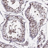 Anti-CCNK Prestige Antibodies® Powered by Atlas Antibodies, affinity isolated antibody