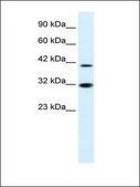 Anti-IRF2 (AB1) antibody produced in rabbit affinity isolated antibody