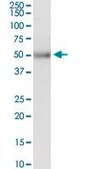 Anti-KRT83 antibody produced in rabbit purified immunoglobulin, buffered aqueous solution